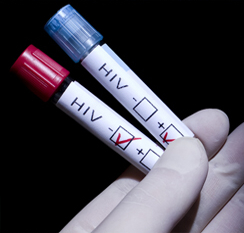 Evropský týden testování HIV 2014