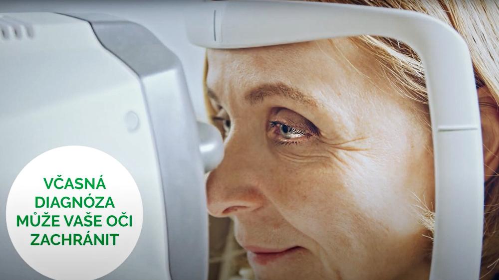 Světový týden glaukomu ilustrační obrázek